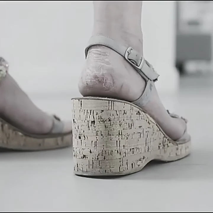 Electric Callus Remover – USB Rechargeable Foot Care Tool (Pakistan)