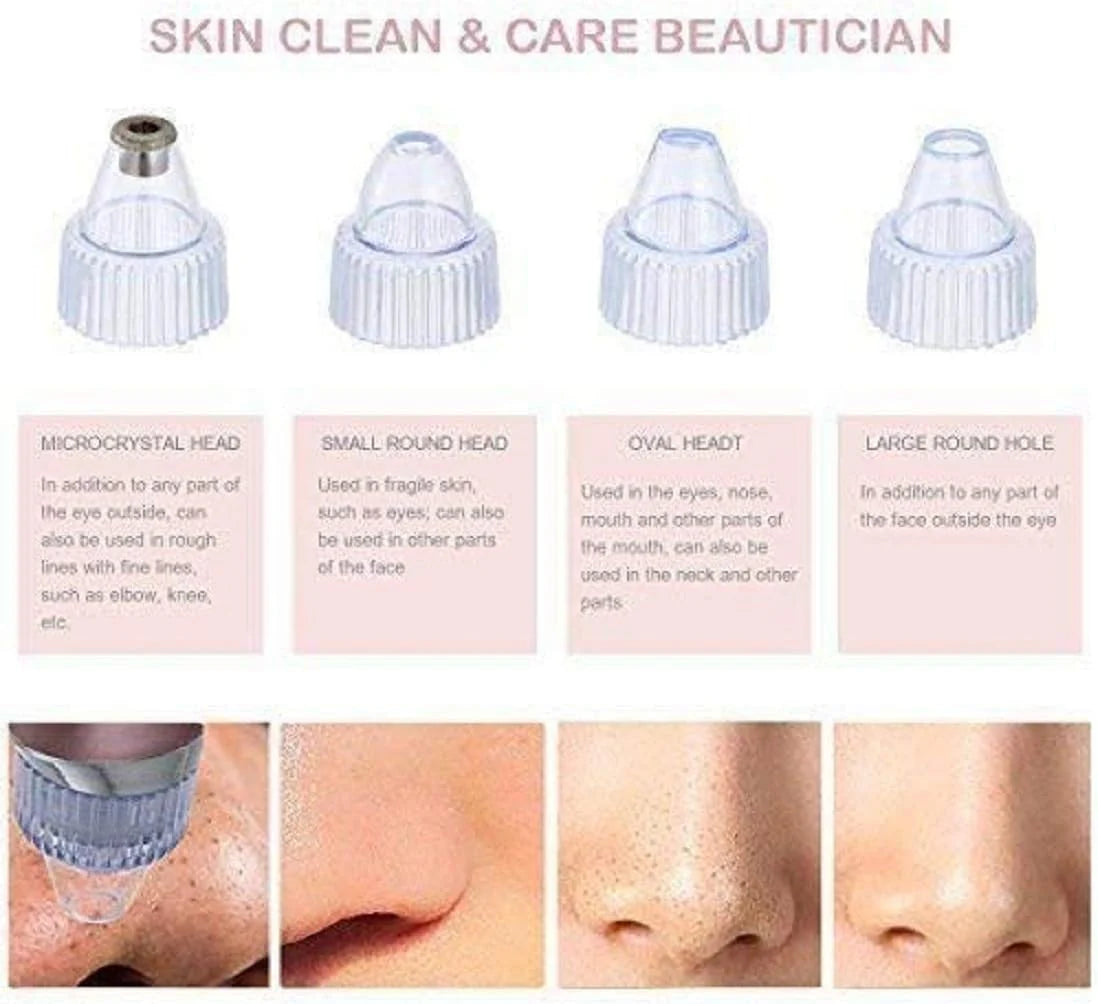 Deep Clean Pore Vacuum – USB Rechargeable Blackhead Remover for Clear Skin